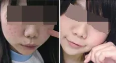 案例