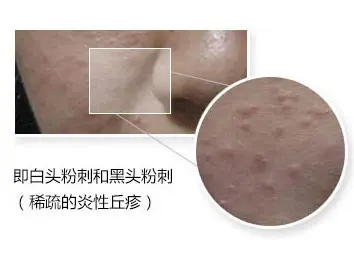 症状