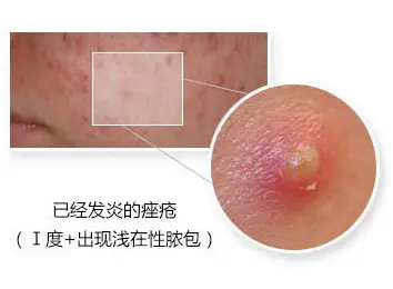 症状