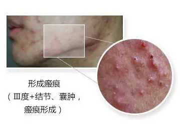 症状