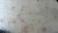 额头