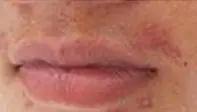 嘴唇