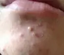 下巴