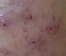 左脸颊