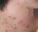 右脸颊